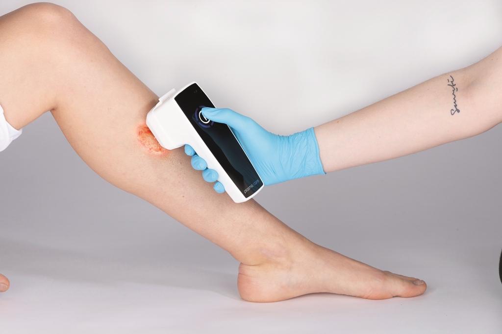 Συσκευή ψυχρού πλάσματος για την θεραπεία τραυμάτων και δερματολογικών παθήσεων